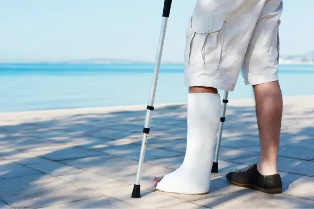 Will they let you on a plane with a cast?